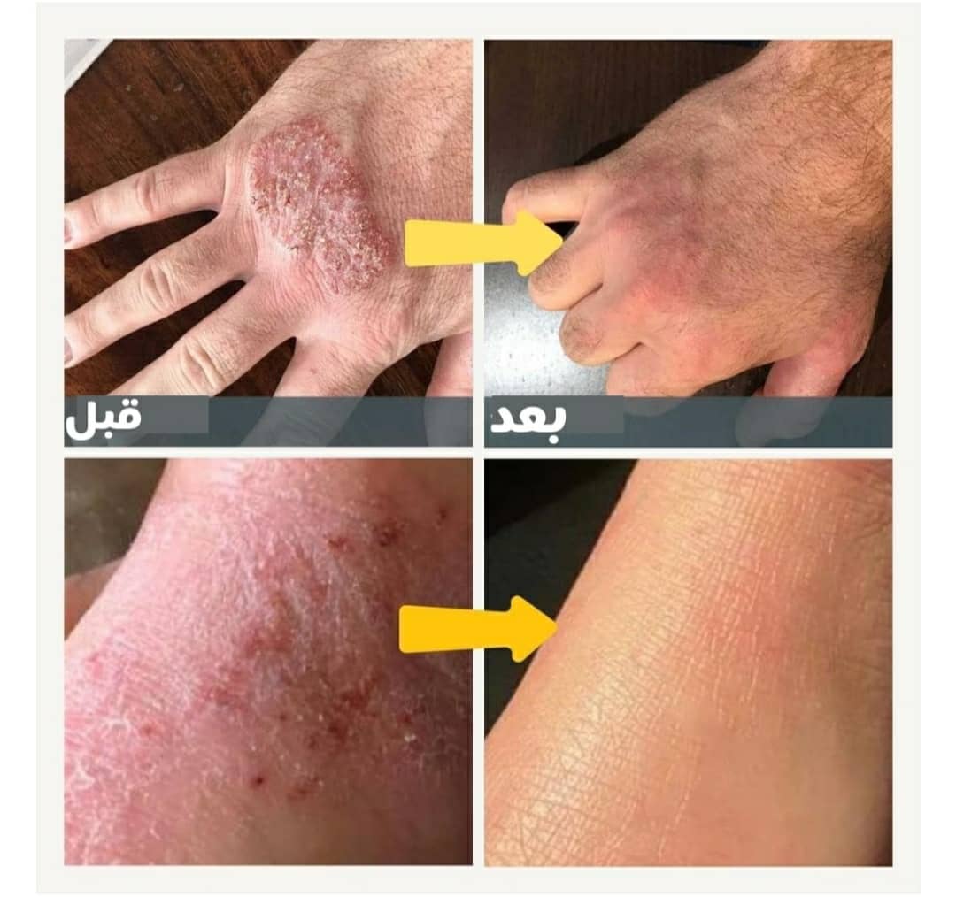 كريم درموفيت