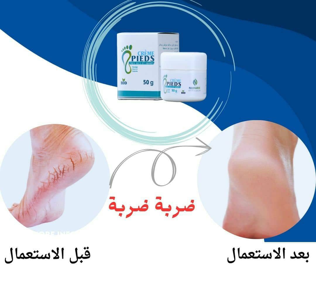 كريم تشقق  القدمين