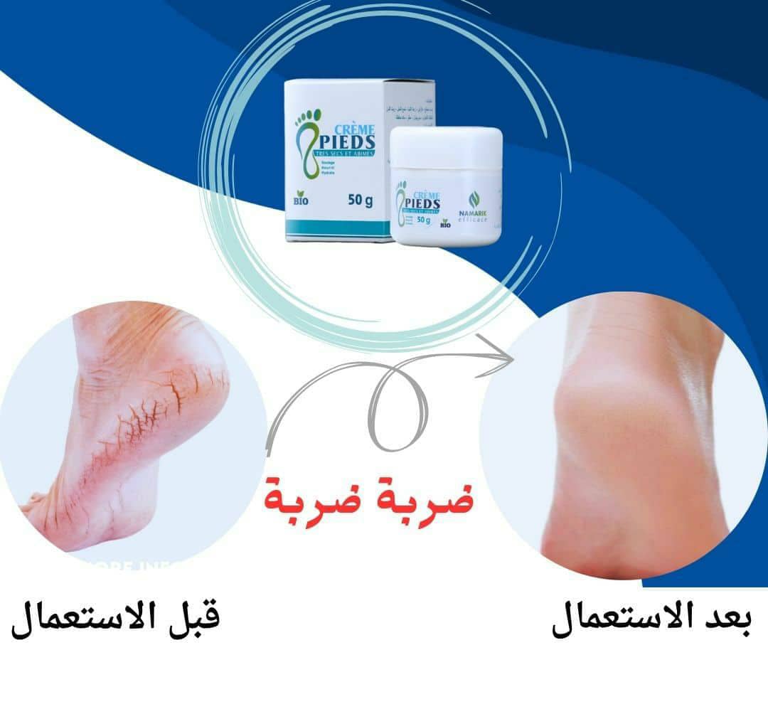 كريمة تشقق  القدمين +جوارب السيليكون